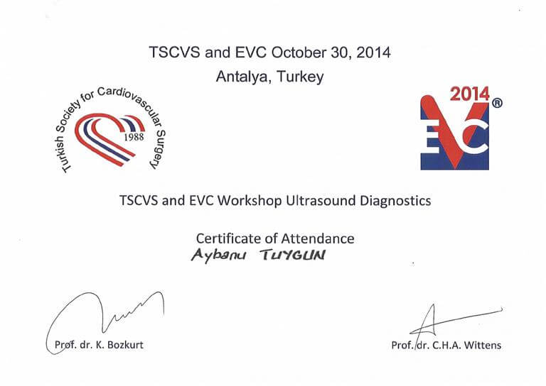 EVC Turkey USG 2014
